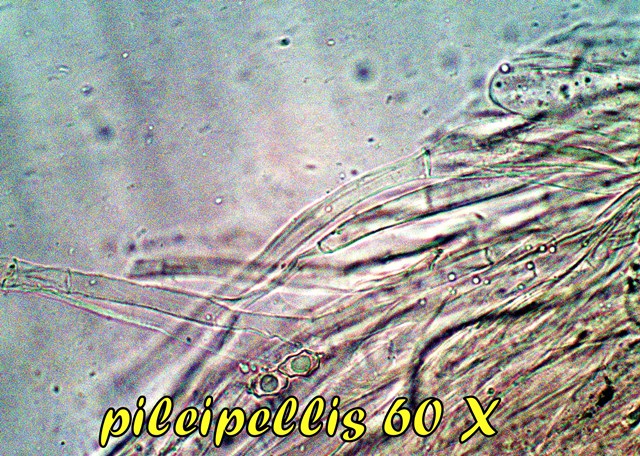 MICROSCOPIA ENTOLOMA REINWALDII